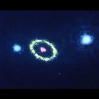 Gaseous Ring Around Supernova 1987A
