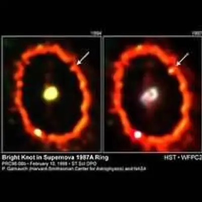 Bright Knot Appears in Supernova 1987a Ring