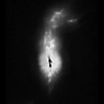 HST Image of R Aquarii