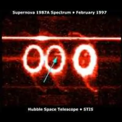 STIS Discovers High-Speed Gas from Collision Around Supernova 1987a