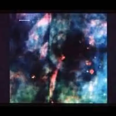 Jet Structure in the Orion Nebula