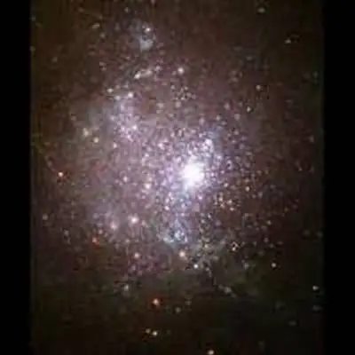 A Blaze of Stars in the Core of Dwarf Galaxy NGC 1705