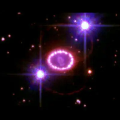 A String of 'Cosmic Pearls' Surrounds an Exploding Star
