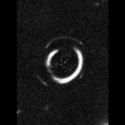 Gravitational Lens System SDSSJ0946+1006 (Zoom onto Double Einstein Ring)