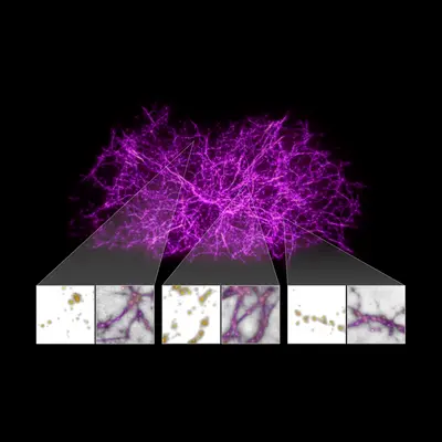 Cosmic Web and Slime Mold