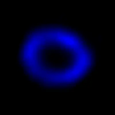 A Chandra View of Supernova 1987A