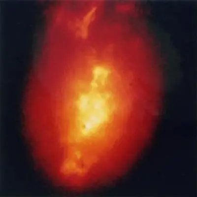 Early Hubble Image of Galaxy NGC 1068