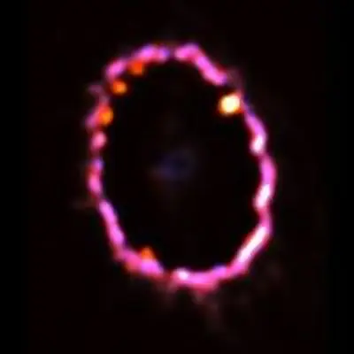 Gas Ring Around Supernova 1987A -- Feb. 2, 2000